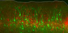 Immagine della corteccia cerebrale: i neuroni rossi sono normali, mentre i neuroni verdi hanno subito una mutazione che ha causato la perdita del gene chiamato PTEN. Nell’uomo, la presenza di un mosaico genetico di questo tipo per PTEN causa una malattia neurologica grave, la displasia corticale. E' evidente come i neuroni malati (in verde) siano più grandi di quelli sani (rossi) ed occupano una frazione più grande dello spessore della corteccia. Queste caratteristiche anatomiche riepilogano ciò che avviene