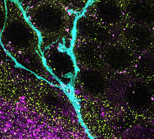 Image of a neuronal process generated by human hippocampal stem cells after transplantation in the mouse hippocampus. In cyan, the process of the transplanted cell. The presinaptic protein VGLUT1 is shown in magenta, and the post-synaptic PSD95 is shown in yellow.  Sparse contacts between mouse and human neurons can be seen in white overlap.