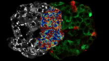 Il segnale intrinseco del tessuto pancreatico umano eccitato da luce infrarossa (sinistra) viene combinato con il segnale specifico degli anticorpi (destra) per l'identificazione delle cellule alpha e beta e della loro risposta metabolica al glucosio (centro)