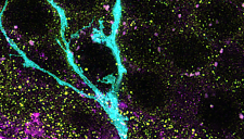 Image of a neuronal process generated by human hippocampal stem cells after transplantation in the mouse hippocampus. In cyan, the process of the transplanted cell. The presinaptic protein VGLUT1 is shown in magenta, and the post-synaptic PSD95 is shown in yellow.  Sparse contacts between mouse and human neurons can be seen in white overlap.