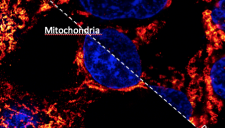 Imaging ad alta risoluzione spaziale di cellule pancreatiche sane e della loro alterazione strutturale in presenza di infiammazione indotta da citochine